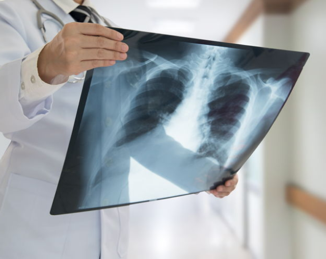 Tendencias en radiología para 2022 con mayores beneficios