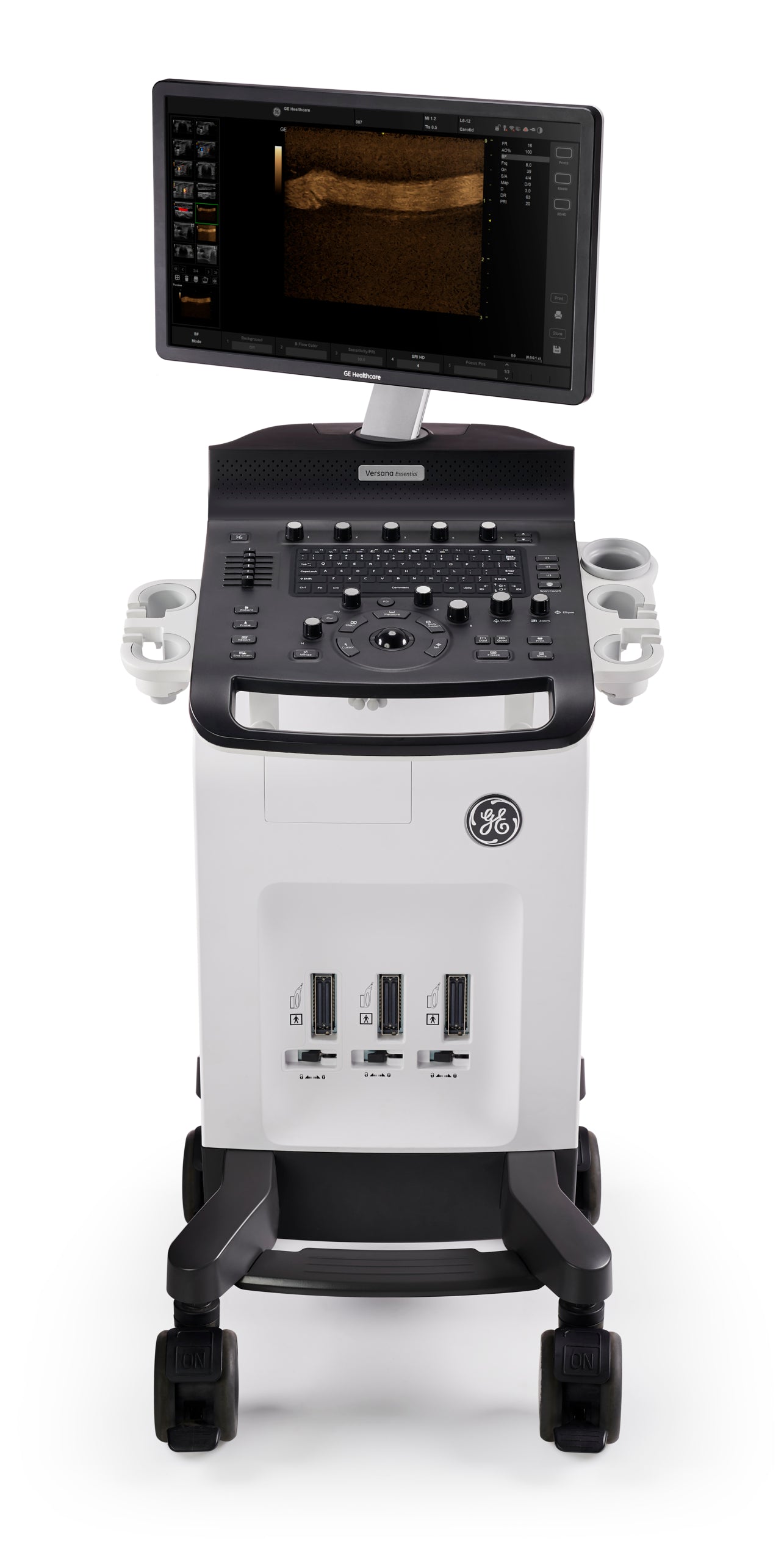 Ecógrafo | Estacionario | GE | Versana Essential | Sonda lineal